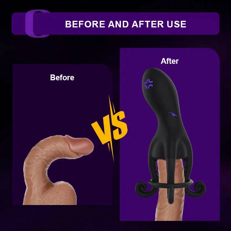 XG11 - Hands-Free Octopus Penis-Vibrator mit verstellbarem Cockring-Support